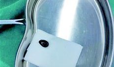 吃瓜呛气管,揭秘意外事件背后的惊险瞬间