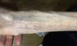 沂水女子吃瓜事件,一场引发社会热议的街头冲突